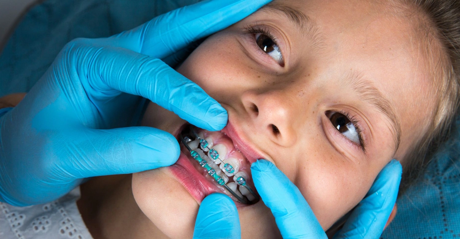 Braces for Kids Inblog